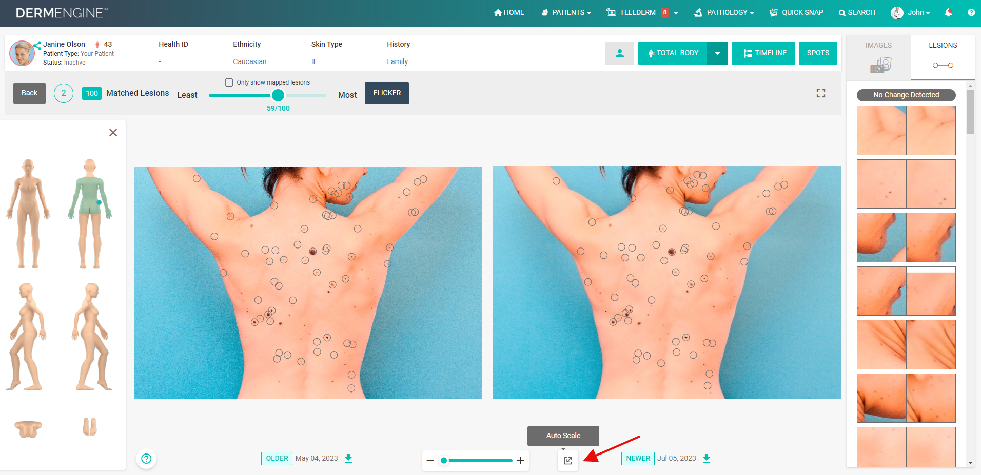 Dermengine Kit Exploring DermEngine's Innovative New Features