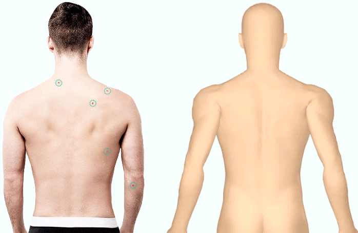 DermEngine Total Body Photography Lesion Mapping GIF Cropped
