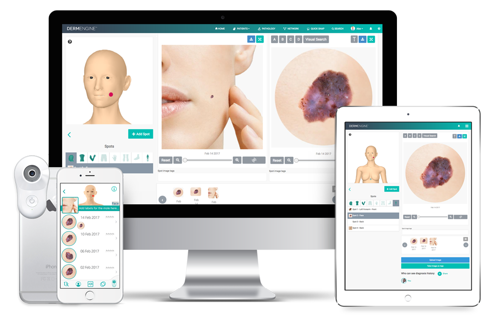 Total Body Photography (whole body screening) captures and analyzes full body images for lesion detection and the evaluation of new or changing moles