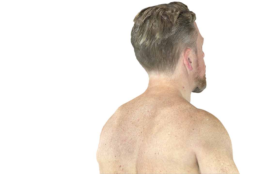 DermEngine 3D TBP Module